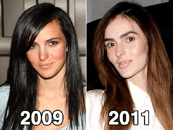 celebs_with_plastic_surgery_04.gif