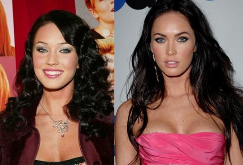 megan+fox+before+and+after+plastic+surgery+2011+%25288%2529.jpg