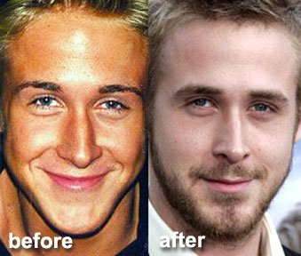 ryan-gosling-plastic-surgery.jpg