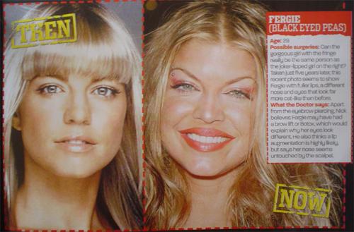 fergie-before-after.jpg