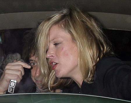 kate-moss-and-jamie-hince-cuts-and-bruises-1.jpg