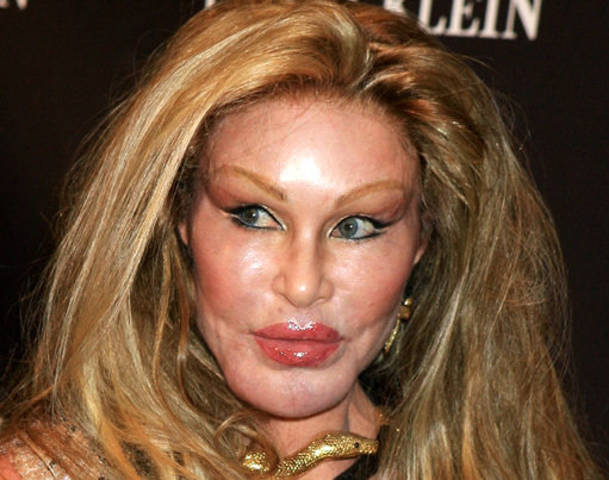 Jocelyn-Wildenstein-Cat-Woman-Plastic-Surgery-lip-injections-Before-and-After-Photos-Worst-Plastic-Surgery-photos-6.jpg
