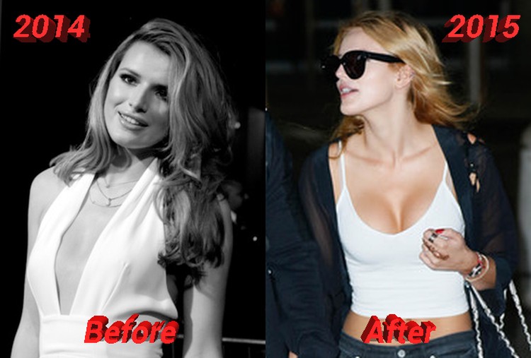 Bella-Thorne-Breast-Implants-Before-and-After.jpg