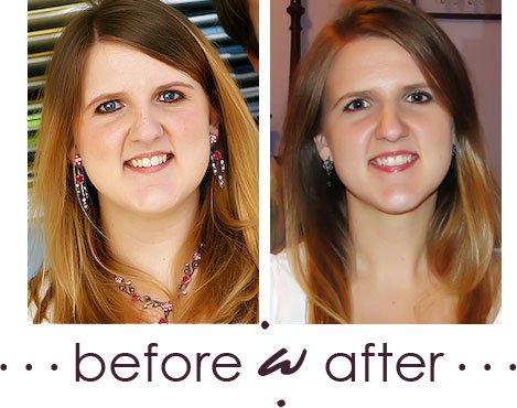 before-and-after-30lb-weightloss-face.jpg